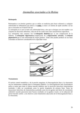 Anomalías en estructura interna del ojo