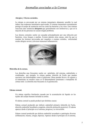 Anomalías en estructura interna del ojo