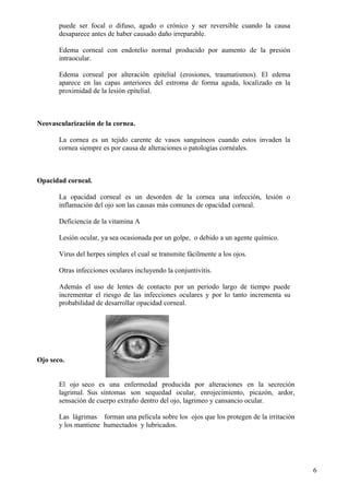 Anomalías en estructura interna del ojo