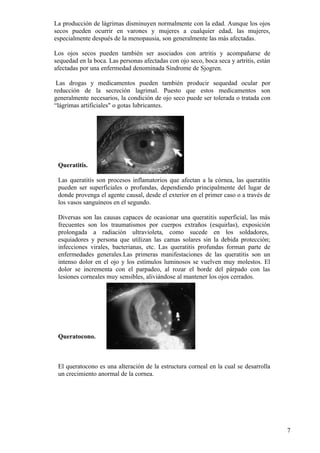 Anomalías en estructura interna del ojo
