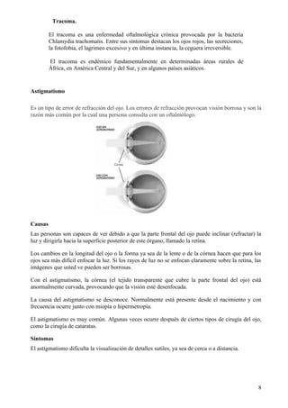 Anomalías en estructura interna del ojo