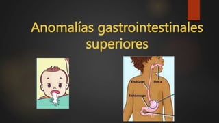 Anomalías gastrointestinales
superiores
 