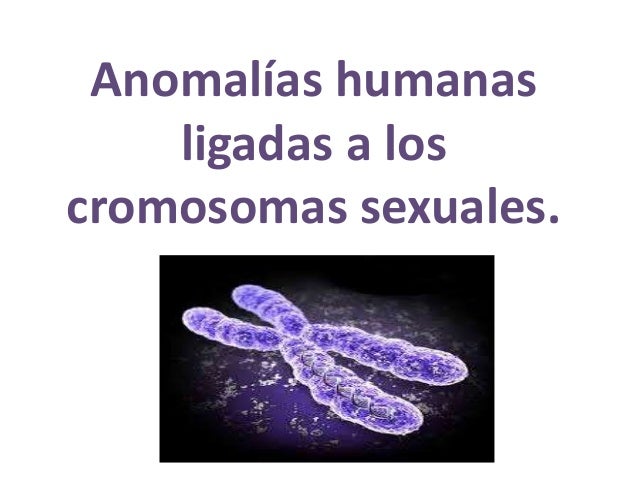 Anomalías humanas ligadas a los cromosomas sexuales