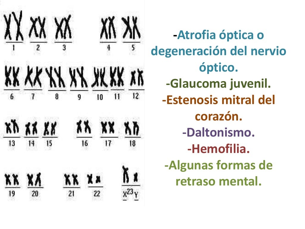 Anomalías humanas ligadas a los cromosomas sexuales