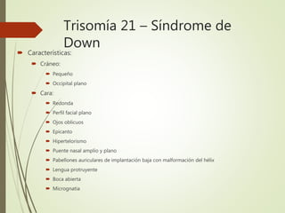 Trisomía 21 – Síndrome de
Down
 Características:
 Cráneo:
 Pequeño
 Occipital plano
 Cara:
 Redonda
 Perfil facial plano
 Ojos oblicuos
 Epicanto
 Hipertelorismo
 Puente nasal amplio y plano
 Pabellones auriculares de implantación baja con malformación del hélix
 Lengua protruyente
 Boca abierta
 Micrognatia
 