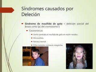 Síndromes causados por
Deleción
 Síndrome de maullido de gato – deleción parcial del
brazo corto (p) del cromosoma 5
 Características:
 Llanto parecido al maullido de gato en recién nacidos
 Microcefalia
 Retraso mental
 Enfermedades cardiacas congénitas
 