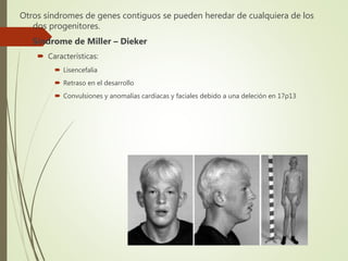 Otros síndromes de genes contiguos se pueden heredar de cualquiera de los
dos progenitores.
 Síndrome de Miller – Dieker
 Características:
 Lisencefalia
 Retraso en el desarrollo
 Convulsiones y anomalías cardíacas y faciales debido a una deleción en 17p13
 