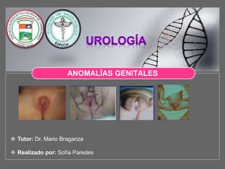 LOGO
ANOMALÍAS GENITALES
 Tutor: Dr. Mario Braganza
 Realizado por: Sofía Paredes
 