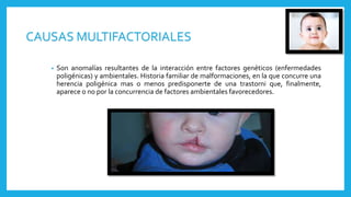 • Son anomalías resultantes de la interacción entre factores genéticos (enfermedades
poligénicas) y ambientales. Historia familiar de malformaciones, en la que concurre una
herencia poligénica mas o menos predisponerte de una trastorni que, finalmente,
aparece o no por la concurrencia de factores ambientales favorecedores.
CAUSAS MULTIFACTORIALES
 