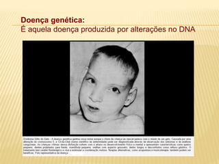 Doença genética:
É aquela doença produzida por alterações no DNA
 