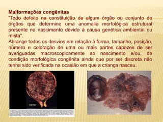 Malformações congênitas
"Todo defeito na constituição de algum órgão ou conjunto de
órgãos que determine uma anomalia morfológica estrutural
presente no nascimento devido à causa genética ambiental ou
mista".
Abrange todos os desvios em relação à forma, tamanho, posição,
número e coloração de uma ou mais partes capazes de ser
averiguadas macroscopicamente ao nascimento e/ou, de
condição morfológica congênita ainda que por ser discreta não
tenha sido verificada na ocasião em que a criança nasceu.
 