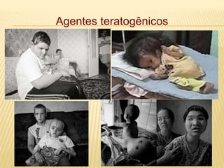 Agentes teratogênicos
 