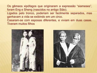Os gêmeos xipófagos que originaram a expressão “siameses”,
foram Eng e Sheng (nascidos no antigo Sião).
Ligados pelo tronco, poderiam ser facilmente separados, mas
ganhavam a vida se exibindo em um circo.
Casaram-se com esposas diferentes, e viviam em duas casas.
Tiveram muitos filhos
 