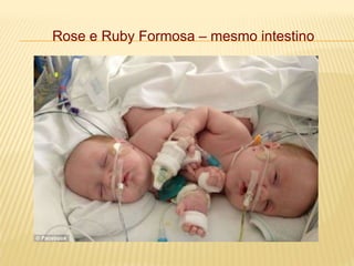 Rose e Ruby Formosa – mesmo intestino
 