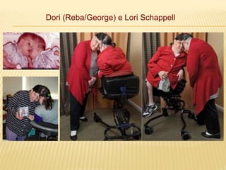Dori (Reba/George) e Lori Schappell
 