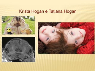 Krista Hogan e Tatiana Hogan
 