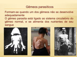 Gêmeos parasíticos
Formam-se quando um dos gêmeos não se desenvolve
adequadamente
O gêmeo parasita está ligado ao sistema circulatório do
gêmeo normal, e se alimenta dos nutrientes de seu
sangue
 