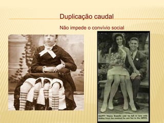 Duplicação caudal
Não impede o convívio social
 