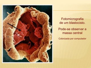 Fotomicrografia
de um blastocisto.
Pode-se observar a
massa central
Colorizada por computador
 