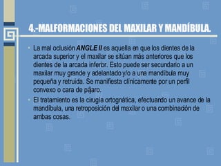4.-MALFORMACIONES DEL MAXILAR Y MANDÍBULA. La mal oclusión  ANGLE II  es aquella en que los dientes de la arcada superior y el maxilar se sitúan más anteriores que los dientes de la arcada inferior. Esto puede ser secundario a un maxilar muy grande y adelantado y/o a una mandíbula muy pequeña y retruida. Se manifiesta clínicamente por un perfil convexo o cara de pájaro. El tratamiento es la cirugía ortognática, efectuando un avance de la mandíbula, una retroposición del maxilar o una combinación de ambas cosas.   