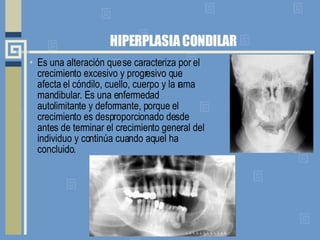 HIPERPLASIA CONDILAR Es una alteración que se caracteriza por el crecimiento excesivo y progresivo que afecta el cóndilo, cuello, cuerpo y la rama mandibular. Es una enfermedad autolimitante y deformante, porque el crecimiento es desproporcionado desde antes de terminar el crecimiento general del individuo y continúa cuando aquel ha concluido.  