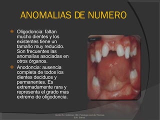 ANOMALIAS DE NUMERO Oligodoncia: faltan mucho dientes y los existentes tiene un tamaño muy reducido.  Son frecuentes las anomalías asociadas en otros órganos. Anodoncia: ausencia completa de todos los dientes deciduos y permanentes. Es extremadamente rara y representa el grado mas extremo de oligodoncia. Gorlin RJ, Goldman HM. Patologia oral de Thomas. Edit. Salvat.  