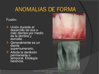 ANOMALIAS DE FORMA Fusión:  Unión durante el desarrollo de dos o más dientes por medio de la dentina y esmalte.  Generalmente es un diente supernumerario. Afecta la dentición permanente o temporal. Etiología herencia. Gorlin RJ, Goldman HM. Patologia oral de Thomas. Edit. Salvat.  