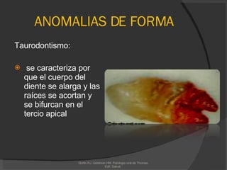 ANOMALIAS DE FORMA Taurodontismo: se caracteriza por que el cuerpo del diente se alarga y las raíces se acortan y se bifurcan en el tercio apical Gorlin RJ, Goldman HM. Patologia oral de Thomas. Edit. Salvat.  