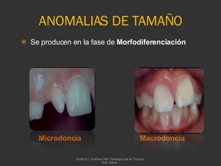 ANOMALIAS DE TAMAÑO Microdoncia Macrodoncia Se producen en la fase de  Morfodiferenciación   Gorlin RJ, Goldman HM. Patologia oral de Thomas. Edit. Salvat.  
