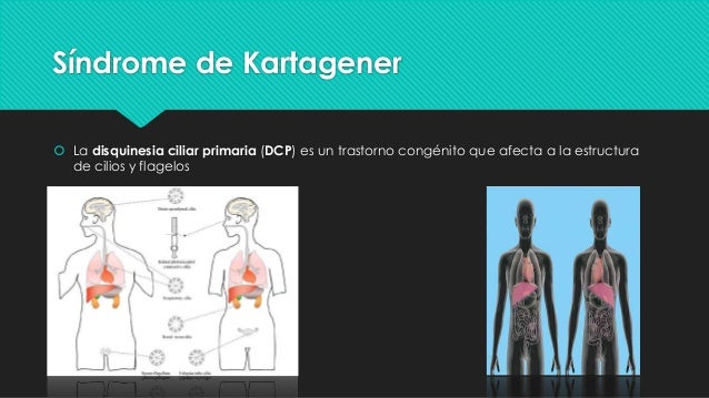 Anomalias congenitas