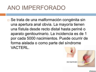 ANO IMPERFORADO 
 Se trata de una malformación congénita sin 
una apertura anal obvia. La mayoría tienen 
una fístula desde recto distal hasta periné o 
aparato genitourinario. La incidencia es de 1 
por cada 5000 nacimientos. Puede ocurrir de 
forma aislada o como parte del síndrome 
VACTERL. 
 