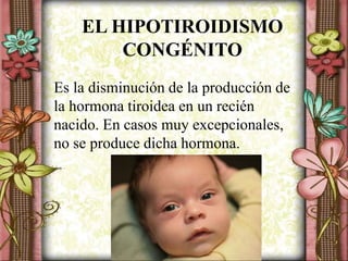 EL HIPOTIROIDISMO
CONGÉNITO
Es la disminución de la producción de
la hormona tiroidea en un recién
nacido. En casos muy excepcionales,
no se produce dicha hormona.
 