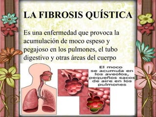 LA FIBROSIS QUÍSTICA
Es una enfermedad que provoca la
acumulación de moco espeso y
pegajoso en los pulmones, el tubo
digestivo y otras áreas del cuerpo
 