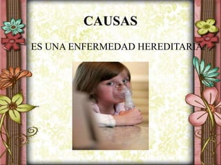 CAUSAS
ES UNA ENFERMEDAD HEREDITARIA.
 