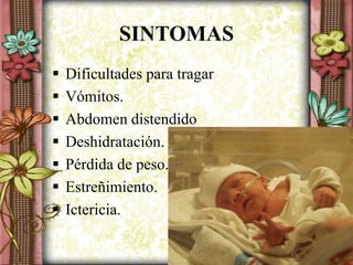 SINTOMAS
 Dificultades para tragar
 Vómitos.
 Abdomen distendido
 Deshidratación.
 Pérdida de peso.
 Estreñimiento.
 Ictericia.
 