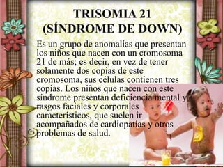 TRISOMIA 21
(SÍNDROME DE DOWN)
Es un grupo de anomalías que presentan
los niños que nacen con un cromosoma
21 de más; es decir, en vez de tener
solamente dos copias de este
cromosoma, sus células contienen tres
copias. Los niños que nacen con este
síndrome presentan deficiencia mental y
rasgos faciales y corporales
característicos, que suelen ir
acompañados de cardiopatías y otros
problemas de salud.
 