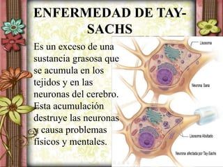ENFERMEDAD DE TAY-
SACHS
Es un exceso de una
sustancia grasosa que
se acumula en los
tejidos y en las
neuronas del cerebro.
Esta acumulación
destruye las neuronas
y causa problemas
físicos y mentales.
 