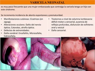 VARICELA NEONATAL
es muy poco frecuente que una mujer embarazada que contraiga la varicela tenga un hijo con
este síndrome.
Se incrementa incidencia de aborto espontaneo y prematuridad.
• Manifestaciones cutáneas: Cicatrices (en
zigzag).
• Alteraciones oculares: Daño del nervio
óptico, Cataratas, atrofia óptica.
• Defectos de extremidades.
• Daño cerebral: Encefalitis, Microcefalia,
hidrocefalia.
• Trastornos a nivel de columna lumbosacra:
déficit motor y sensorial, ausencia de
reflejos profundos, disfunción de esfínteres
anal y vesical
• Daño sensorial.
 