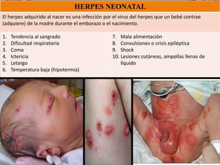 HERPES NEONATAL
El herpes adquirido al nacer es una infección por el virus del herpes que un bebé contrae
(adquiere) de la madre durante el embarazo o el nacimiento.
1. Tendencia al sangrado
2. Dificultad respiratoria
3. Coma
4. Ictericia
5. Letargo
6. Temperatura baja (hipotermia)
7. Mala alimentación
8. Convulsiones o crisis epiléptica
9. Shock
10. Lesiones cutáneas, ampollas llenas de
líquido
 