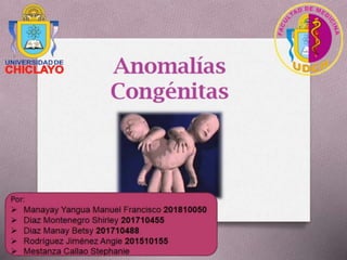Anomalías Congénitas  -M.Y.M.F.