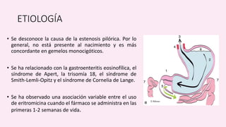 ANOMALIAS CONGENITAS DEL TUBO DIGESTIVO. | PPTX