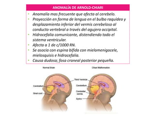 ANOMALÍA DE ARNOLD-CHIARI
• Anomalía mas frecuente que afecta al cerebelo.
• Proyección en forma de lengua en el bulbo raquídeo y
desplazamiento inferior del vermis cerebeloso al
conducto vertebral a través del agujero occipital.
• Hidrocefalia comunicante, distendiendo todo el
sistema ventricular.
• Afecta a 1 de c/1000 RN.
• Se asocia con espina bífida con mielomenigocele,
mielosquisis e hidrocefalia.
• Causa dudosa; fosa craneal posterior pequeña.
 
