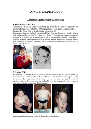 ANOMALIAS CROMOSÓMICAS 
Anomalias Cromosómicas Estructurales 
1 Síndrome Cri du Chat 
Anualmente, el Cri du Chat o "síndrome del maullido de gato" se encuentra en 
aproximadamente uno en 20.000 a 50.000 nacimientos vivos en los Estados Unidos. 
La causa del Cri du Chat es la deleción del cromosoma 5p. 
Las características de los bebés que sufren Cri du Chat son: llanto muy agudo, falta de 
tonicidad muscular, microcefalia y bajo peso al nacer. También tienen problemas con el 
lenguaje, y es posible que se expresen a través de una cantidad reducida de palabras o 
lenguaje de señas. Otros problemas de salud que pueden presentarse incluyen retardo 
para comenzar a caminar, problemas en la alimentación, hiperactividad, escoliosis y 
retardo mental severo. 
2 Prader Willy 
El síndrome de Prader-Willi es causado por la carencia de un gen en parte del 
cromosoma 15. Normalmente, cada uno de los padres transmite una copia de este 
cromosoma. La mayoría de los pacientes con este síndrome carecen del material 
genético en parte del cromosoma del padre. El resto de los pacientes con frecuencia 
tiene dos copias del cromosoma 15 de la madre. 
Los signos del síndrome de Prader-Willi pueden verse al nacer. 
 