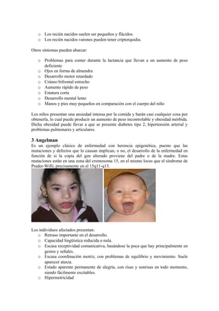 o Los recién nacidos suelen ser pequeños y flácidos. 
o Los recién nacidos varones pueden tener criptorquidia. 
Otros síntomas pueden abarcar: 
o Problemas para comer durante la lactancia que llevan a un aumento de peso 
deficiente 
o Ojos en forma de almendra 
o Desarrollo motor retardado 
o Cráneo bifrontal estrecho 
o Aumento rápido de peso 
o Estatura corta 
o Desarrollo mental lento 
o Manos y pies muy pequeños en comparación con el cuerpo del niño 
Los niños presentan una ansiedad intensa por la comida y harán casi cualquier cosa por 
obtenerla, lo cual puede producir un aumento de peso incontrolable y obesidad mórbida. 
Dicha obesidad puede llevar a que se presente diabetes tipo 2, hipertensión arterial y 
problemas pulmonares y articulares. 
3 Angelman 
Es un ejemplo clásico de enfermedad con herencia epigenética, puesto que las 
mutaciones y defectos que lo causan implican, o no, el desarrollo de la enfermedad en 
función de si la copia del gen alterado proviene del padre o de la madre. Estas 
mutaciones están en una zona del cromosoma 15, en el mismo locus que el síndrome de 
Prader-Willi, precisamente en el 15q11-q13. 
Los individuos afectados presentan: 
o Retraso importante en el desarrollo. 
o Capacidad lingüística reducida o nula. 
o Escasa receptividad comunicativa, basándose la poca que hay principalmente en 
gestos y señales. 
o Escasa coordinación motriz, con problemas de equilibrio y movimiento. Suele 
aparecer ataxia. 
o Estado aparente permanente de alegría, con risas y sonrisas en todo momento, 
siendo fácilmente excitables. 
o Hipermotricidad 
 