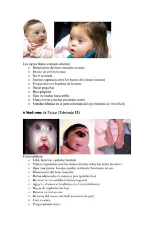Los signos físicos comunes abarcan: 
o Disminución del tono muscular al nacer 
o Exceso de piel en la nuca 
o Nariz achatada 
o Uniones separadas entre los huesos del cráneo (suturas) 
o Pliegue único en la palma de la mano 
o Orejas pequeñas 
o Boca pequeña 
o Ojos inclinados hacia arriba 
o Manos cortas y anchas con dedos cortos 
o Manchas blancas en la parte coloreada del ojo (manchas de Brushfield) 
6 Síndrome de Patau (Trisomia 13) 
Características: 
o Labio leporino o paladar hendido 
o Manos empuñadas (con los dedos externos sobre los dedos internos) 
o Ojos muy juntos: los ojos pueden realmente fusionarse en uno 
o Disminución del tono muscular 
o Dedos adicionales en manos o pies (polidactilia) 
o Hernias: hernia umbilical, hernia inguinal 
o Agujero, división o hendidura en el iris (coloboma) 
o Orejas de implantación baja 
o Retardo mental severo 
o Defectos del cuero cabelludo (ausencia de piel) 
o Convulsiones 
o Pliegue palmar único 
 