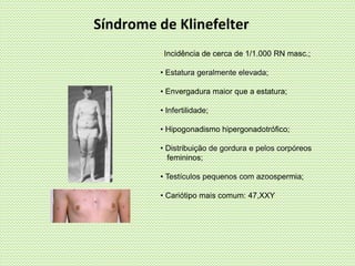 Síndrome de Klinefelter
• Incidência de cerca de 1/1.000 RN masc.;
• Estatura geralmente elevada;
• Envergadura maior que a estatura;
• Infertilidade;
• Hipogonadismo hipergonadotrófico;
• Distribuição de gordura e pelos corpóreos
femininos;
• Testículos pequenos com azoospermia;
• Cariótipo mais comum: 47,XXY
 