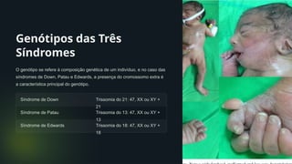 Genótipos das Três
Síndromes
O genótipo se refere à composição genética de um indivíduo, e no caso das
síndromes de Down, Patau e Edwards, a presença do cromossomo extra é
a característica principal do genótipo.
Síndrome de Down Trissomia do 21: 47, XX ou XY +
21
Síndrome de Patau Trissomia do 13: 47, XX ou XY +
13
Síndrome de Edwards Trissomia do 18: 47, XX ou XY +
18
 