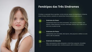 Fenótipos das Três Síndromes
O fenótipo é a expressão física do genótipo. As três síndromes, apesar de compartilharem a trissomia,
exibem fenótipos distintos, resultando em características físicas próprias de cada síndrome.
1 Síndrome de Down
Características físicas como olhos amendoados, nariz pequeno e achatado, boca
pequena, orelhas pequenas e um pouco mais baixas, pescoço curto e mãos com um
sulco único na palma da mão.
2 Síndrome de Patau
Características como microcefalia, lábio leporino, olhos pequenos e defeitos no ouvido
externo, além de polidactilia.
3 Síndrome de Edwards
Mãos e pés pequenos, dedos sobrepostos e unhas finas e pequenas, microcefalia,
orelhas de implantação baixa, mandíbula pequena, além de defeitos cardíacos.
 