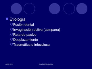Etiología
Fusión dental
Invaginación activa (campana)
Retardo pasivo
Desplazamiento
Traumática o infecciosa
JUNIO 2015 Edna Edith Morales Silva
 