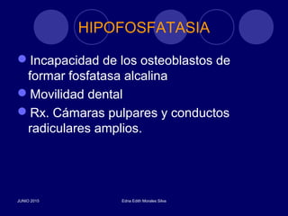 HIPOFOSFATASIA
Incapacidad de los osteoblastos de
formar fosfatasa alcalina
Movilidad dental
Rx. Cámaras pulpares y conductos
radiculares amplios.
JUNIO 2015 Edna Edith Morales Silva
 